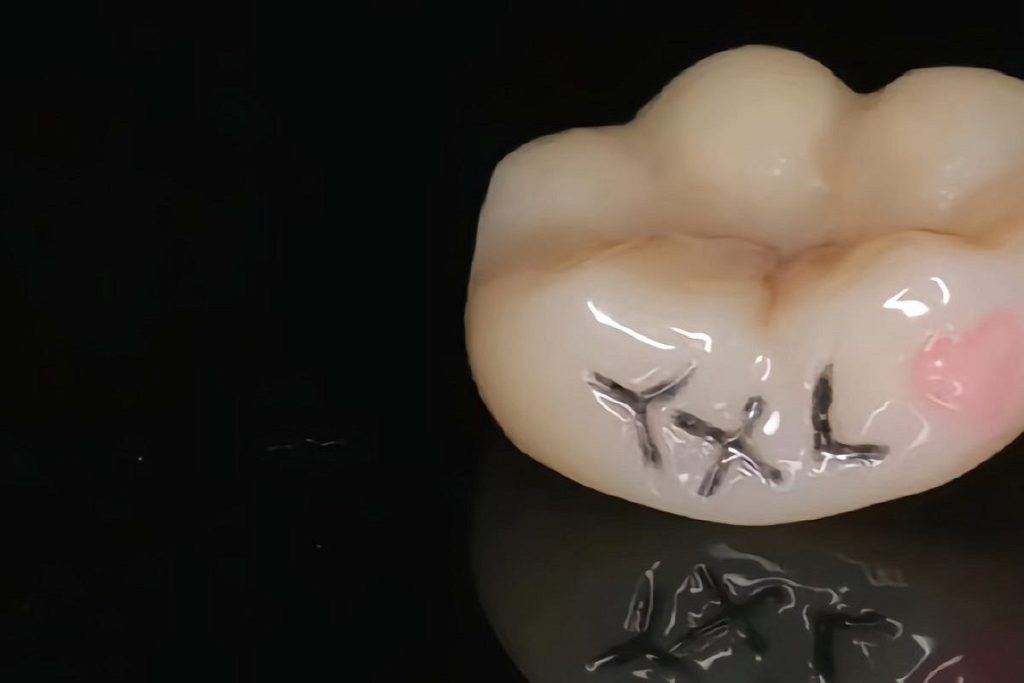 Улыбка с изюминкой: в Китае набирают популярность татуировки на зубах